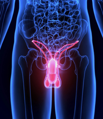 Erectile dysfunction