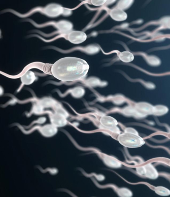 Low sperm count - Evaluation & treatment