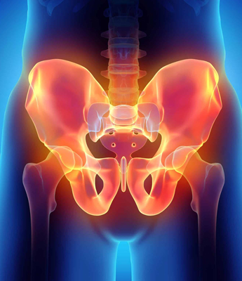 Constan groin pain