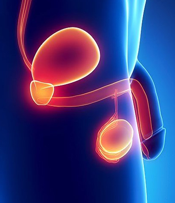 Hernia and hydrocele