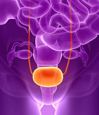 Urethral calculus