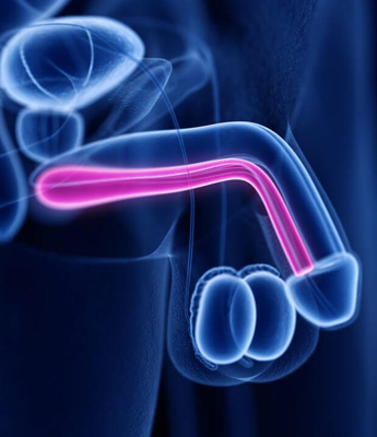 Curvature of penis