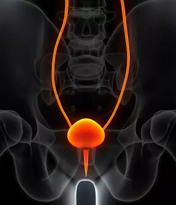 Urine retention